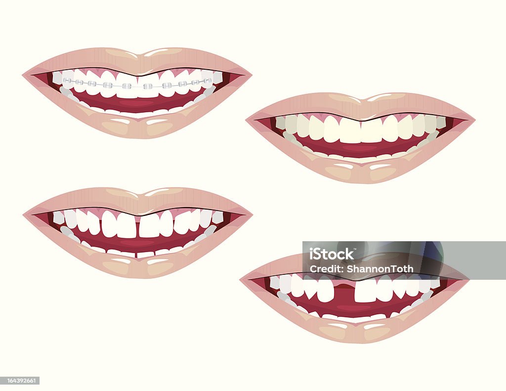 Dental estética - arte vectorial de Fealdad libre de derechos