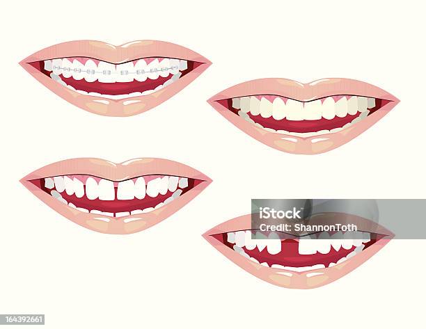 歯科の美学 - 人間の唇のベクターアート素材や画像を多数ご用意 - 人間の唇, 醜さ, アイコン