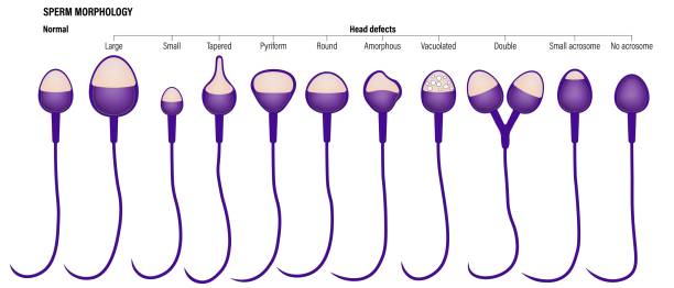 Sperm Condition 180+ Sperm Motility Stock Photos, Pictures & Royalty-Free Images - iStock