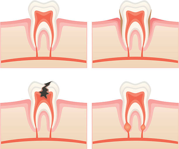 ból zęba - human teeth gums dental hygiene inflammation stock illustrations