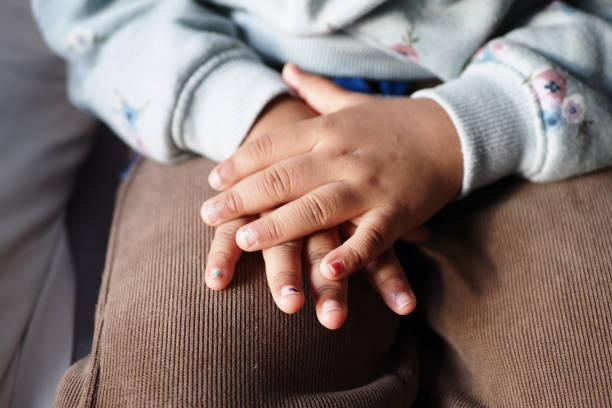 istock child suffering from itching skin on hand 1644360179