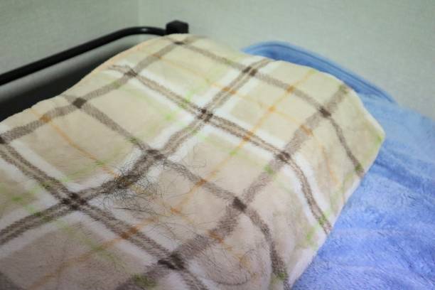istock Lots of hair loss on pillow 1644568549