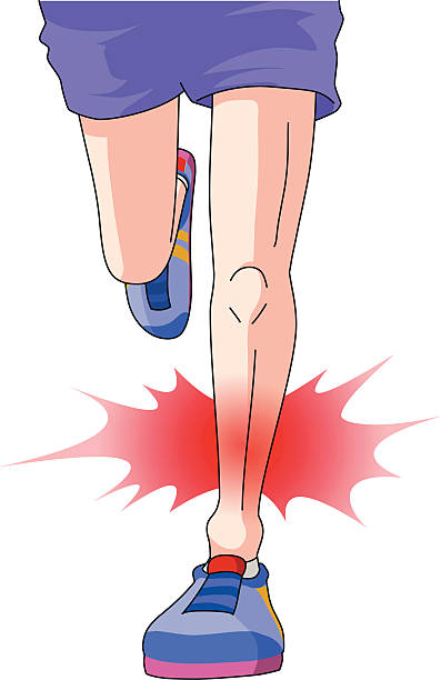 Shin Splints Icon 60+ Running Shin Stock Illustrations, Royalty-Free Vector Graphics ...