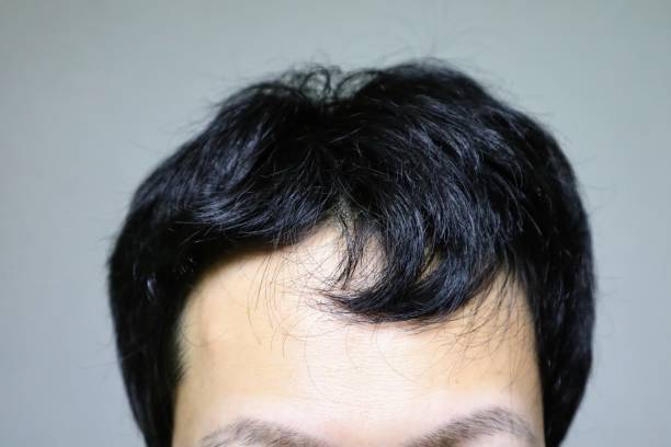 istock Japanese man with thin hair 1644673728