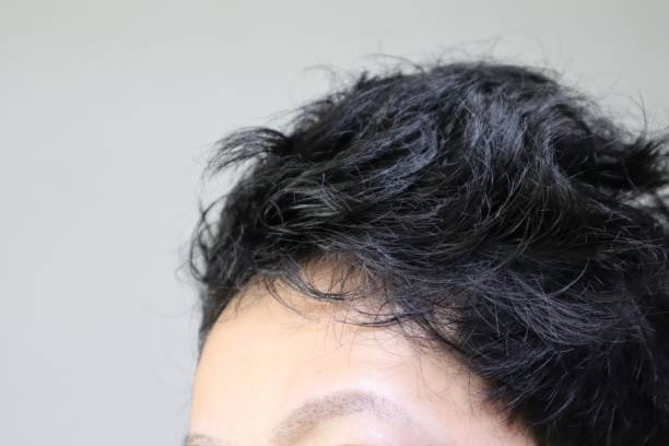 istock A Japanese man who covers thin hair with a hairstyle 1644695180
