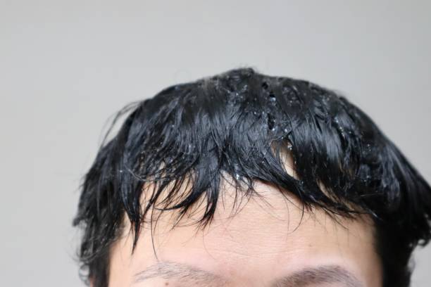 istock Japanese man after shampoo 1644719677