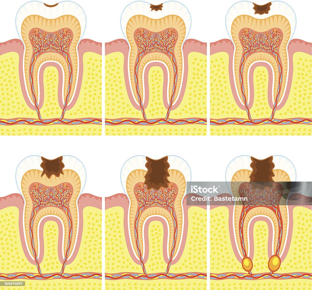 Wewnętrzną strukturę zęba - Grafika wektorowa royalty-free (Anatomia człowieka)