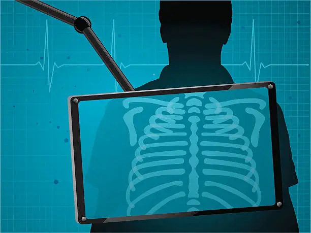 Vector illustration of X-ray monitoring