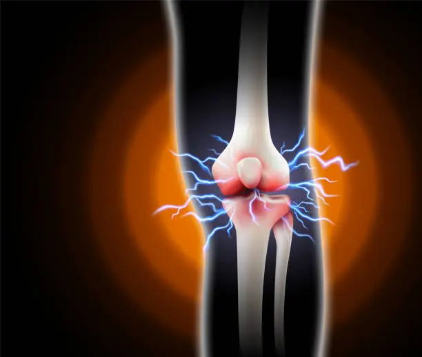 Vector illustration of Knee pain and pain in the bones