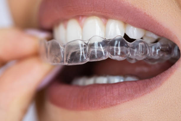 istock Clear Aligner Dental Night Guard 1645852546
