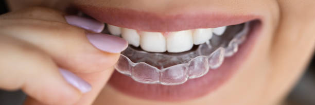 istock Clear Aligner Dental Night Guard 1645853107