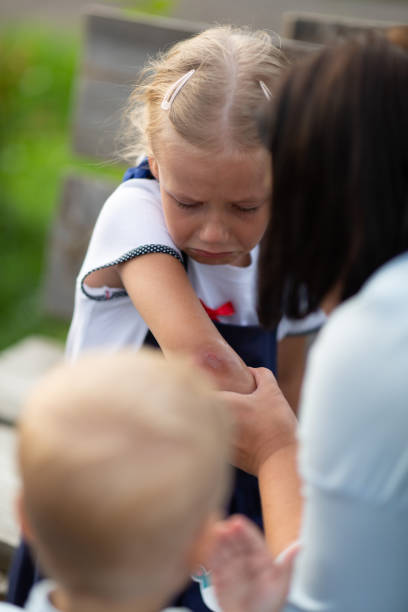 istock A girl shows her mother a torn elbow from a fall 1645973222