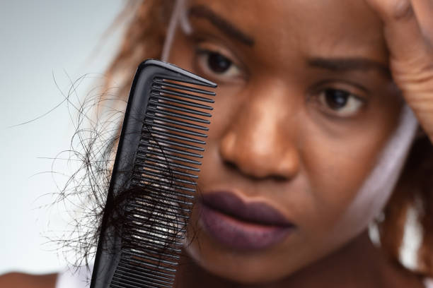 istock Shocked Woman Suffering From Hair Loss Problem 1646206057