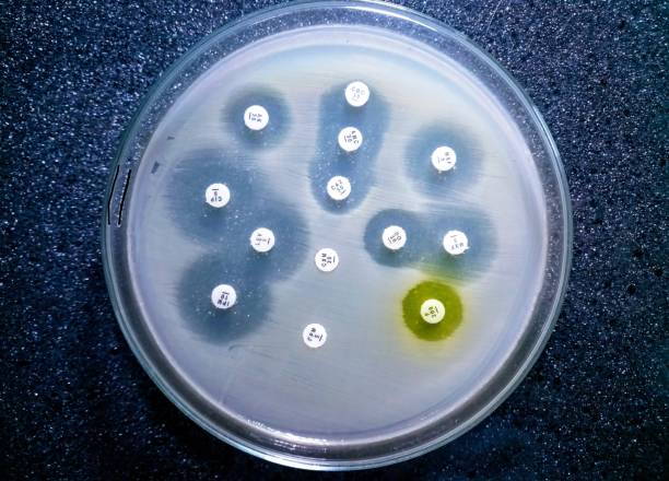 паттерн esbl положителен в тесте чувствительности e. coli. - esbl стоковые фото и изображения