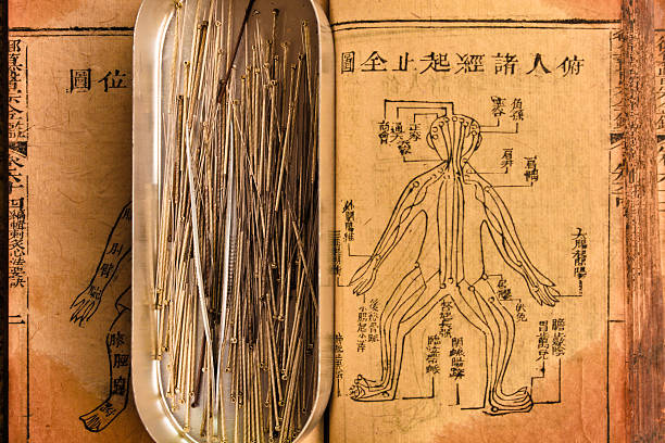 akupunkturnadel - acupuncture chinese medicine medicine chinese script stock-fotos und bilder