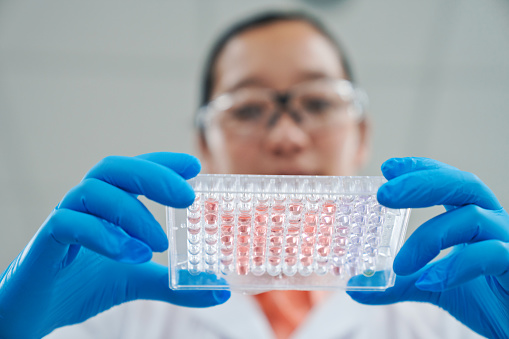 Low angle view of female scientist holding tray of medical samples in laboratory