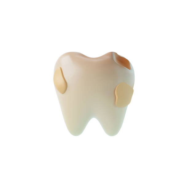 istock Realistic unhealthy yellow tooth with hole and caries 3D style, vector illustration 1648673645