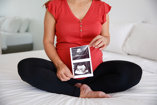 Front view shot of unrecognizable pregnant woman showing ultrasound image in front of her abdomen while sitting on the bed