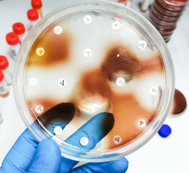 istock Antibiotic Susceptibility testing of Pseudomonas cepacia bacterium. Burkholderia cepacia 1649917689