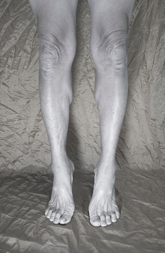 The muscles of the legs of the elderly with atrophy