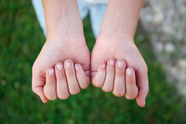 istock The child shows his hands with dirt under his nails. 1650115425