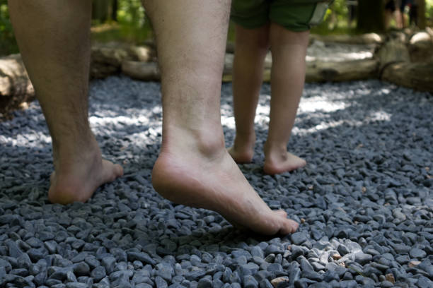Treatment and prevention of flat feet in children