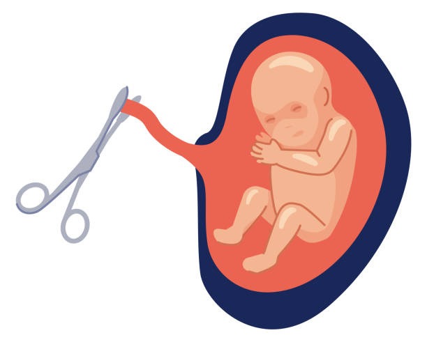 ilustrações, clipart, desenhos animados e ícones de cortando cordão umbilical. ícone dos desenhos animados do nascimento do bebê - umblical cord