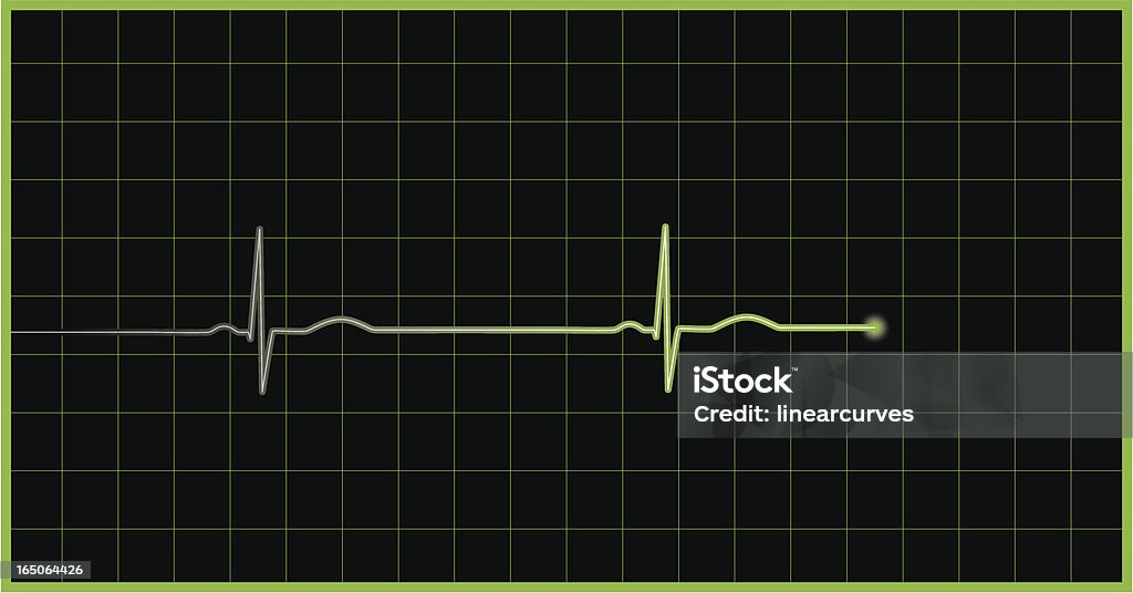 ECG wave normale - clipart vectoriel de Fond libre de droits