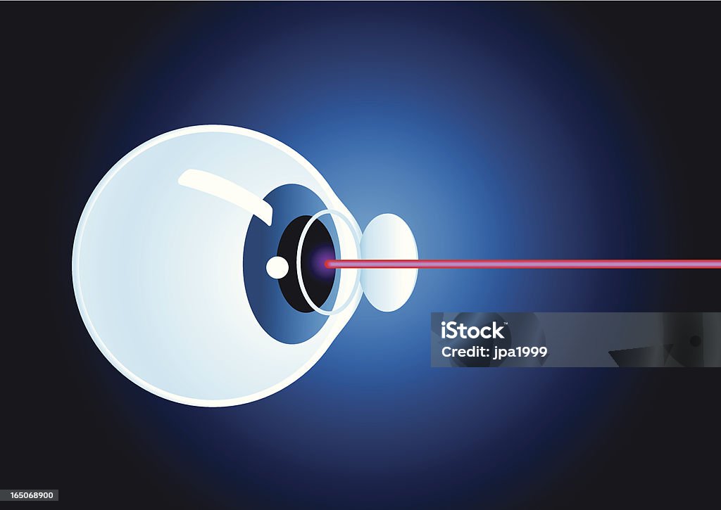 Laser Cirurgia ocular - Royalty-free Laser arte vetorial