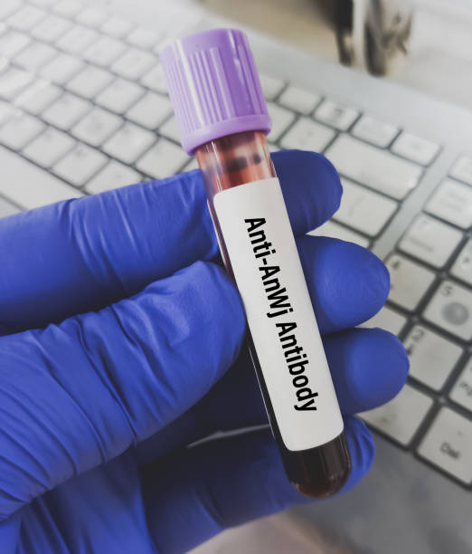 80+ Aplastic Anemia Photos Stock Photos, Pictures & RoyaltyFree Images 80+ Aplastic Anemia Photos Stock Photos, Pictures & RoyaltyFree Images