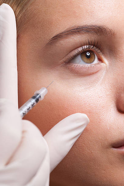 close-up da mulher recebendo injeção de botox de olhos - abaixo - fotografias e filmes do acervo