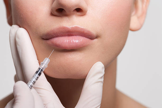 primer plano de mujer recibiendo inyección de botox en los labios - attractive female human collagen syringe injecting fotografías e imágenes de stock