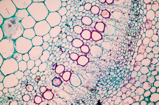 A microscope slide showing a stained section of a human bowel, or small intestine.  It was taken through microscope lens that has a central focus through a thin layer of glass.