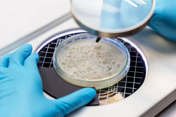 petri dish for analysis and cultivate bacteria molds and fungal testing clinical samples by using colony counter in laboratory. - petri dish agar jelly laboratory glassware bacterium imagens e fotografias de stock