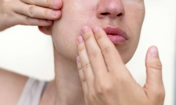 istock millennial woman practising face massage yoga exercises 1652842659