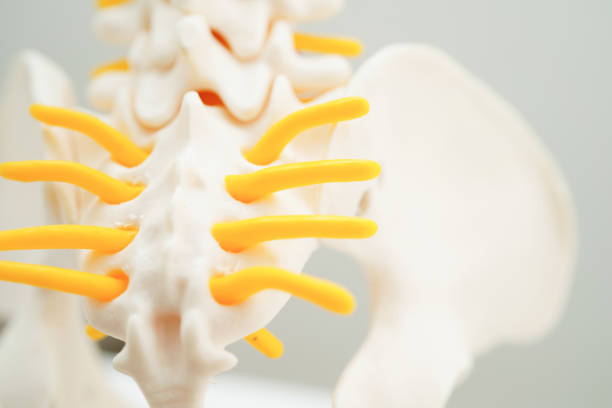 istock Spinal nerve and bone, Lumbar spine displaced herniated disc fragment, Model for treatment medical in the orthopedic department. 1652949325