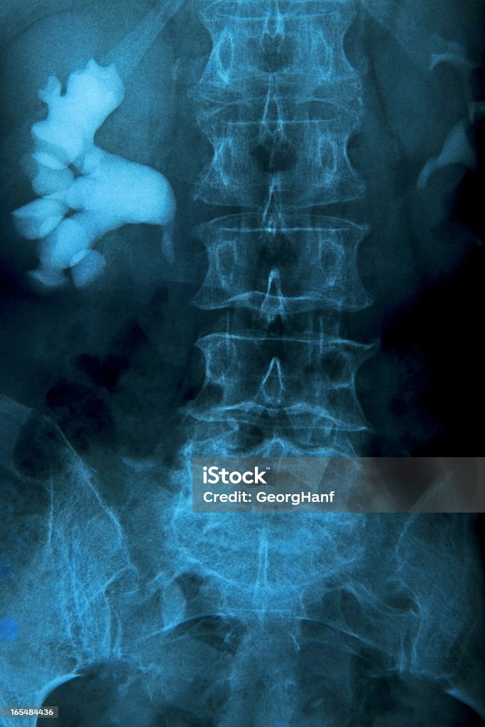 Cuerpo humano - Foto de stock de Sistema urinario libre de derechos