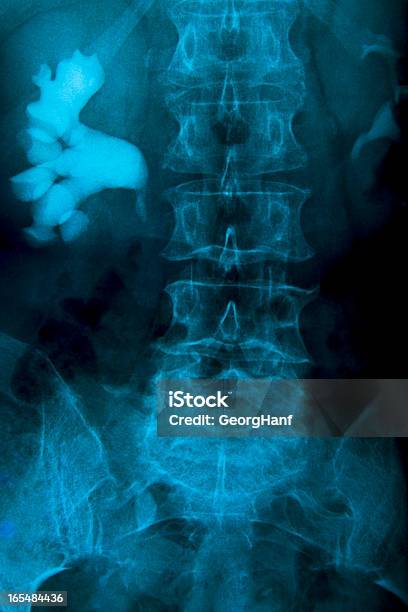 Cuerpo Humano Foto de stock y más banco de imágenes de Sistema urinario - Sistema urinario, Afección médica, Anatomía