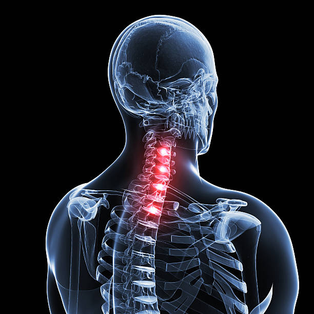 istock painful neck illustration 165495061