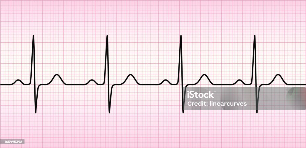 Onda del ECG - arte vectorial de Latido cardíaco libre de derechos