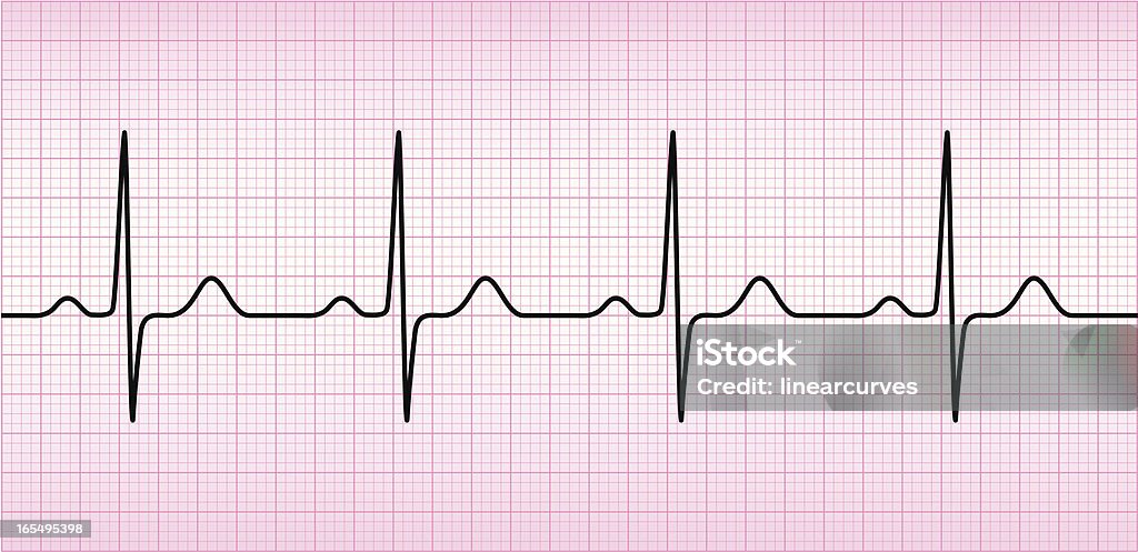 ECG wave ECG wave on printout paper. Electrocardiography stock vector