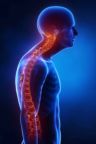 Kyphotic spine lateral view in x-ray stock photo
