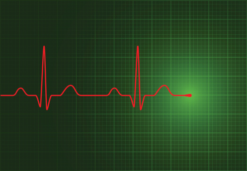 A red ECG trace on a green screen. AI CS3, PDF and XXL jpeg included.