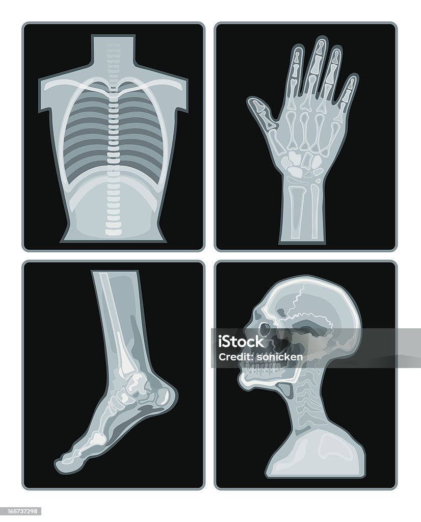 x-ray films collection a set of x-ray films on different part of body. X-ray Image stock vector