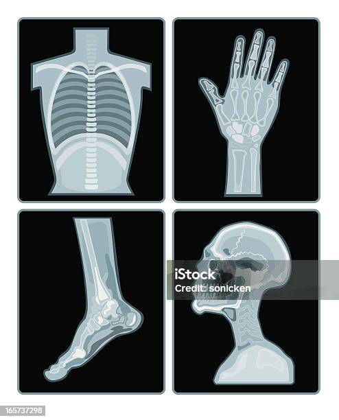 Xray Films Collection Stock Illustration - Download Image Now - X-ray Image, Medical X-ray, Laboratory