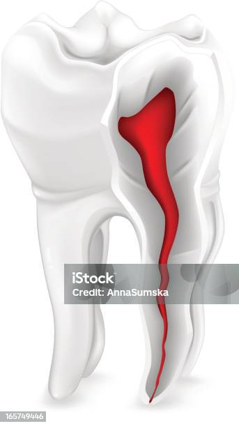 Tooth Secant Tooth In Section Stock Illustration - Download Image Now - Anatomy ...