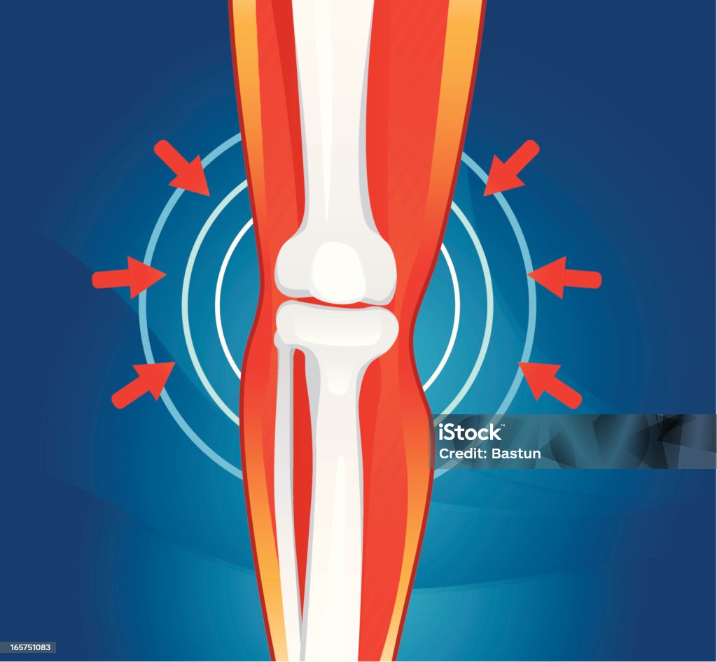 Dor nas articulações - Royalty-free Osteoporose arte vetorial