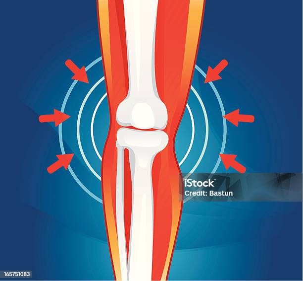 Dor Nas Articulações - Arte vetorial de stock e mais imagens de Osteoporose - Osteoporose, Artrite, Dor