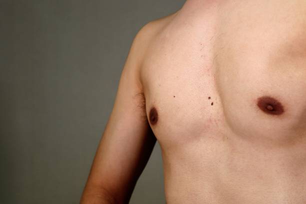 istock Naked man who succeeded in dieting 1657593804