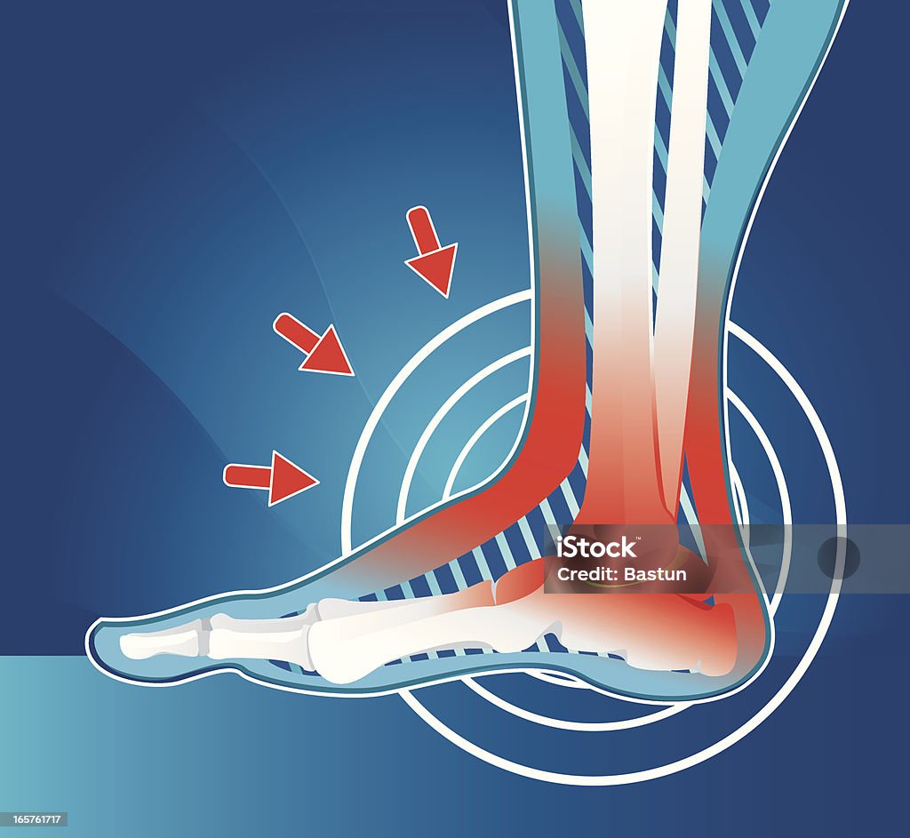 Dolor articular - arte vectorial de Dolor libre de derechos